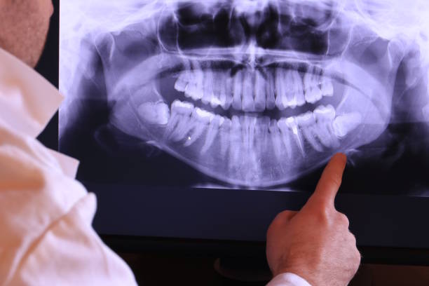 Best Chipped Tooth Repair Near Me  in Oak Park, MI