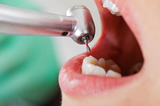 Best Dentist for Tooth Abscess  in Oak Park, MI